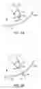 Fig. 03 - Transgastric abdominal access