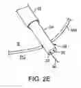 Fig. 05 - Transgastric abdominal access
