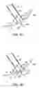 Fig. 06 - Transgastric abdominal access