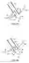 Fig. 07 - Transgastric abdominal access