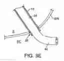 Fig. 08 - Transgastric abdominal access