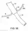 Fig. 13 - Transgastric abdominal access