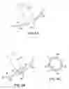 Fig. 14 - Transgastric abdominal access