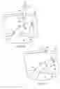 Fig. 28 - Transgastric abdominal access