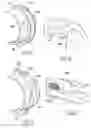 Fig. 06 - Spacing and centering device for a rigid double-wall duct with a low heat transfer coefficient