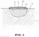 Fig. 04 - High temperature sliding alloy