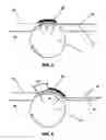 Fig. 05 - Extended couch nip on cylinder former