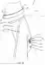 Fig. 02 - Suspension restraint devices