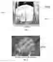 Fig. 03 - Bonded fiber structures for use in blood separation