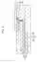 Fig. 04 - Solid state imaging device