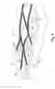 Fig. 09 - Nanoscopic wire-based devices and arrays