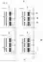 Fig. 06 - Spin injection magnetic domain wall displacement device and element thereof
