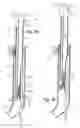 Fig. 04 - Walker device