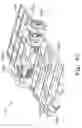 Fig. 62 - Suspensions for low floor vehicles