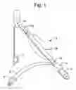 Fig. 02 - Air belt