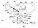 Fig. 32 - Residual magnetic devices and methods