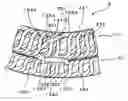Fig. 01 - Stator arrangement of a rotary electric machine having lead wires in sagging contact with the stator winding