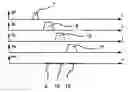 Fig. 01 - Automated positioning of mri surface coils