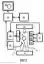 Fig. 06 - Automated positioning of mri surface coils