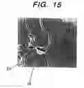 Fig. 09 - Motor using magnet