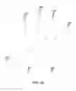 Fig. 35 - IDENTIFYING CONTACTS ON A TOUCH SURFACE