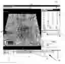 Fig. 01 - System and method for data visualization using a synchronous display of sequential time data and on-map planning