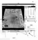 Fig. 04 - System and method for data visualization using a synchronous display of sequential time data and on-map planning