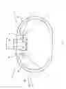 Fig. 02 - Capsule endoscope