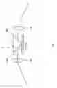 Fig. 04 - Capsule endoscope