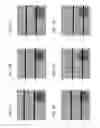 Fig. 04 - Rolling shutter for prevention of blooming