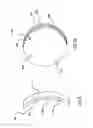 Fig. 08 - Ophthalmic lens for correcting non-conventional refractive error