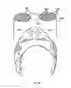 Fig. 11 - Ophthalmic lens for correcting non-conventional refractive error