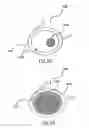 Fig. 12 - Ophthalmic lens for correcting non-conventional refractive error