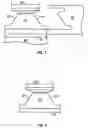 Fig. 02 - HYBRID CONTACT LENS SYSTEM AND METHOD