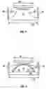 Fig. 03 - HYBRID CONTACT LENS SYSTEM AND METHOD