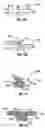Fig. 08 - HYBRID CONTACT LENS SYSTEM AND METHOD