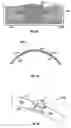 Fig. 17 - HYBRID CONTACT LENS SYSTEM AND METHOD