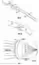Fig. 05 - Hybrid contact lens system and method