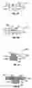 Fig. 08 - Hybrid contact lens system and method