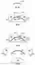 Fig. 14 - Hybrid contact lens system and method
