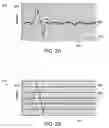 Fig. 03 - Fourier transform infrared spectrometer