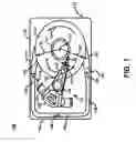Fig. 02 - Collapsible bypass channel disposed outside of disk drive housing