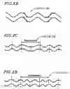 Fig. 03 - Information recording medium, recording apparatus, reproduction apparatus, recording method, and reproduction method