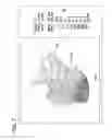 Fig. 09 - Thermal tympanic thermometer