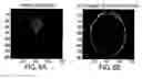 Fig. 08 - Tomographic imaging system using a conformable mirror