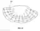 Fig. 11 - Microphone orientation and size in a speakerphone