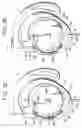 Fig. 08 - Headphone with cord take-up device