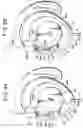 Fig. 09 - Headphone with cord take-up device