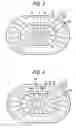 Fig. 03 - Speaker apparatus