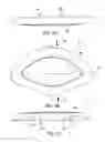 Fig. 08 - Speaker device